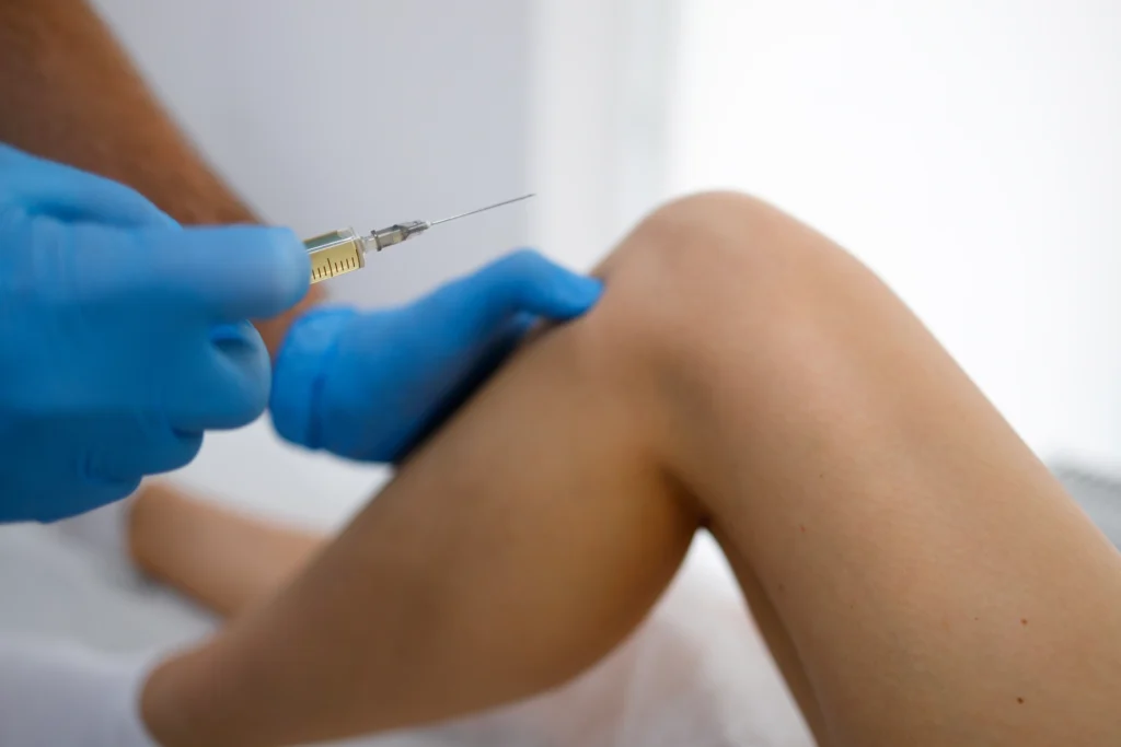 Arthrosamid® injection